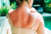 A whopping 76% of Brits use sun cream abroad only to ditch the routine on sunny days in UK