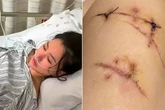 Woman stabbed 22 times in shopping centre carpark – but her boob implants saved her life