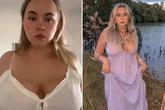 'Men used to always stare at my huge 34E chest - so I did something drastic'