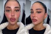 Tulisa shows off swollen new lips after getting them tattooed before I'm A Celeb