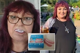Mum buys £14.99 fake teeth on Facebook to fix her smile and it all goes horribly wrong
