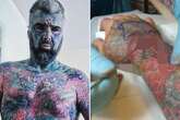 'Britain's most tattooed man' wants body modifications removed - but faces setback