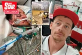 Dad left with half a face after crushing own head in bulldozer horror