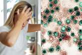 Banging your head could give you herpes as 'zombie' viruses 'wake up', study finds