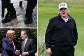 Donald Trump sparks new health fears during UK trip after mystery bruise and 'swollen ankles'