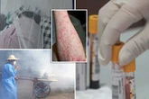 New video exposes chaos in Chinese hospital as new Chikungunya virus 'pandemic' takes hold