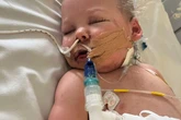 'My toddler's toes disappeared like a horror movie and her screams haunt me daily'