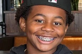 Boy, 13, dies after parasite crawls into brain while swimming in lake