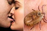 Kissing was invented as a way to remove ticks and lice from each other, scientist claim