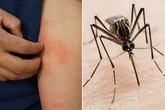 'Worrying' deadly disease which can cause 'pain for years' is surging across the UK