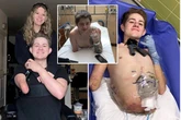 Man cut in half by forklift praises wife and asks people to help make their lives easier