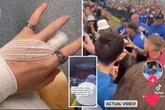 Moment girl celebrating GCSEs 'lost part of finger' in Reading Festival mosh pit