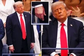 Trump accused of 'using makeup' as bruise badly covered up during US open final