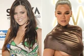 Khloe Kardashian exposes every cosmetic procedure she's had done to her face