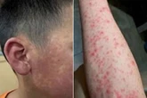 Horror pics of 'new Chinese pandemic' emerge as quarantine imposed after 10,000 cases