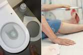 Toilet-related injuries in the home are fairly common as people fall victim to loos