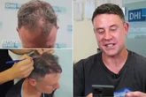 Wayne Bridge reveals £7k hair transplant transformation as wife Frankie gives verdict