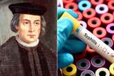 Origins of European syphilis revealed as key explorer caused serious outbreak