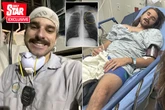 Factory worker who 'vaped every 10 seconds' felt like he was shot when lung collapsed