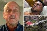 Ex-pilot's theory of how Air India crash's sole survivor escaped the inferno