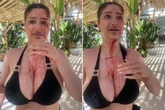 Brit, 20, 'covered in blood' after being hit by champagne bottle in Marbella sunbed row