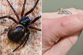 Spiders capable of causing 'rotting flesh' leave record-breaking numbers in hospital