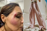Zara's trendy trousers dubbed 'death pants' as wearers keep 'ending up in hospital'