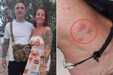 Family's £4,900 holiday 'ruined' as one thing saw them wake up 'covered in itchy sores'