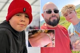Dad slams school as son suffers severe sun burns after 'frying in 30C heat' on trip