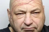 Gory mugshot of dad-of-six covered in scratches after restraining order breaches