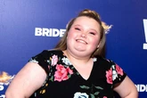 Alana 'Honey Boo Boo' Thompson T-boned in car smash that 'banged her up'