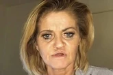 Danniella Westbrook to have six more surgeries as one side of face has 'no bone'