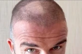 David Beckham left red-faced with huge bald patch after DIY haircut blunder