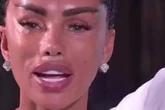 Katie Price pulls stitches out of own face in sickening facelift blunder
