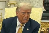 Donald Trump sparks health concerns again as he covers mystery bruises with makeup