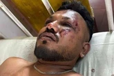 Air India crash survivor accused of lying as famous actor's comments spark backlash