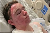 McDonald's worker hospitalised with burns with after 'hot oil thrown by colleague'