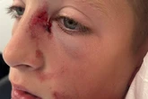 Boy laid on floor squealing with blood all over after horror hit-and-run