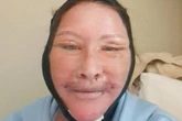 'I spent £6k on Turkey facelift but trolls say it looks like it was done in a kebab shop'