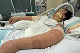 Freak 'robot vacuum explosion' sparks blaze leaving man fighting for life