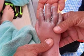Horror as Brit boy, 4, has 'arm sucked into pipe' while playing in Majorca swimming pool