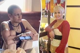 Grandma's transformation after 15 years of meth abuse leaves her 'unrecognisable'
