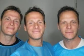 Celeb triplets have world's first matching £5k hair transplants after going bald together