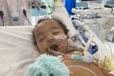 'Miracle' baby suffers heart attack and loses half his tongue in horror incident