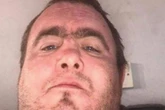 Belfast stabbing victim drugged and torched by gang leader in previous horror attack