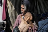 Keir Starmer to hold urgent Gaza talks as emaciated kids images sicken world