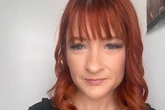 'I drank tea then realised my face was paralysed – now I tape eye shut to sleep'