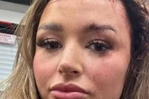 Love Island's Charleen Murphy suffered horrific attack before villa entrance