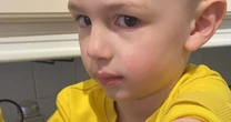 UK's 'most dangerous plant' giant hogweed burns boy, 4, so badly that he stays indoors to avoid sun