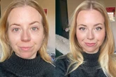 'This £29 cream erased my redness fast - it's now £21 for Amazon Prime Day'